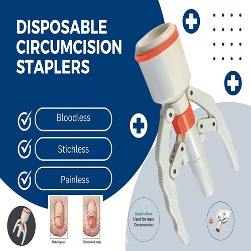 Circumcision Stapler